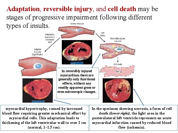 Adaptation, reversible injury, and cell death may be stages of progressive impairment following different