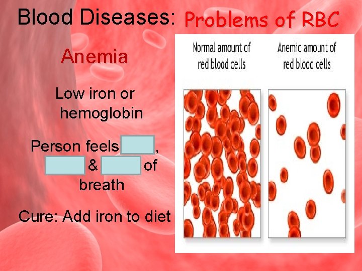 Blood Diseases: Problems of RBC Anemia Low iron or hemoglobin Person feels tired, weak
