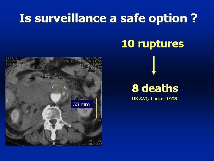 Is surveillance a safe option ? 10 ruptures 8 deaths UK SAT, Lancet 1998