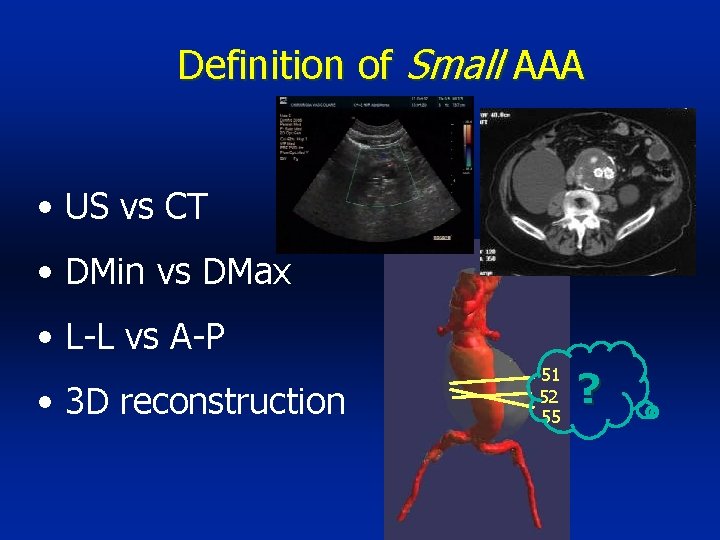 Definition of Small AAA • US vs CT • DMin vs DMax • L-L