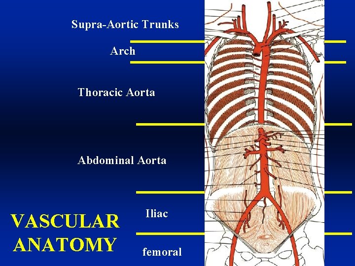 Supra-Aortic Trunks Arch Thoracic Aorta Abdominal Aorta VASCULAR ANATOMY Iliac femoral 