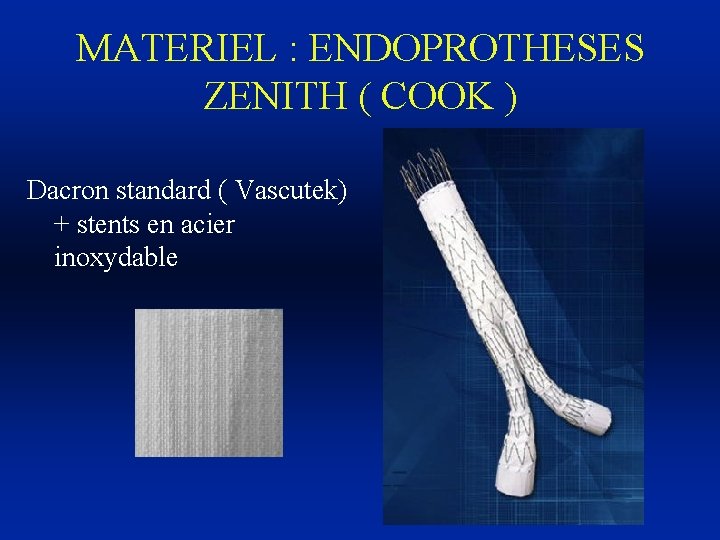 MATERIEL : ENDOPROTHESES ZENITH ( COOK ) Dacron standard ( Vascutek) + stents en