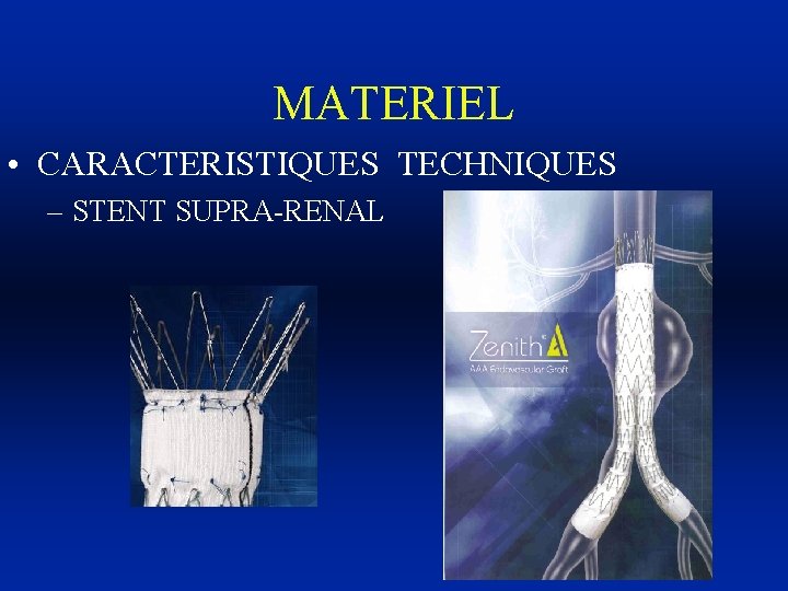 MATERIEL • CARACTERISTIQUES TECHNIQUES – STENT SUPRA-RENAL 