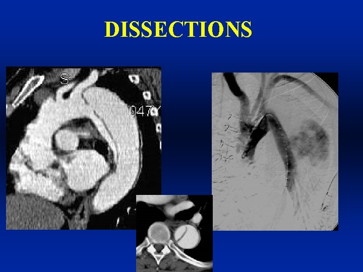 DISSECTIONS 