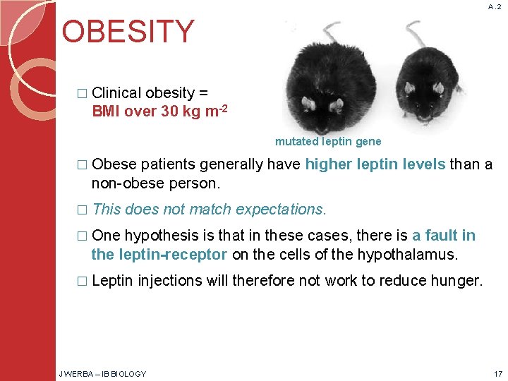 A. 2 OBESITY � Clinical obesity = BMI over 30 kg m-2 mutated leptin