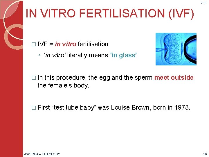 U. 4 IN VITRO FERTILISATION (IVF) � IVF = in vitro fertilisation ◦ ‘in