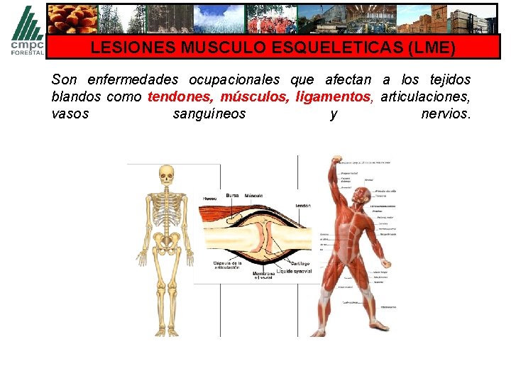 LESIONES MUSCULO ESQUELETICAS (LME) Son enfermedades ocupacionales que afectan a los tejidos blandos como