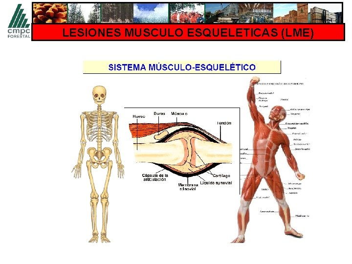 LESIONES MUSCULO ESQUELETICAS (LME) 