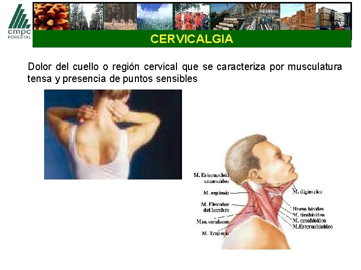 CERVICALGIA Dolor del cuello o región cervical que se caracteriza por musculatura tensa y