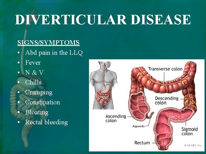 DIVERTICULAR DISEASE SIGNS/SYMPTOMS • Abd pain in the LLQ • Fever • N&V •