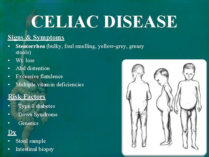 CELIAC DISEASE Signs & Symptoms • Steatorrhea (bulky, foul smelling, yellow-grey, greasy stools) •