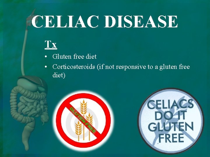 CELIAC DISEASE Tx • Gluten free diet • Corticosteroids (if not responsive to a