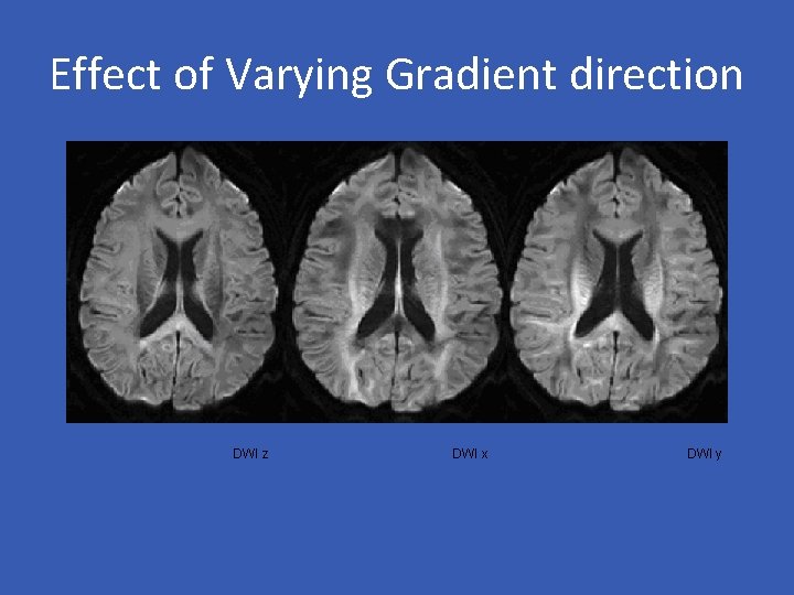 Effect of Varying Gradient direction DWI z DWI x DWI y 