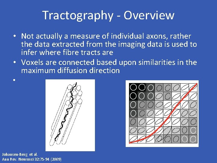 Tractography - Overview • Not actually a measure of individual axons, rather the data