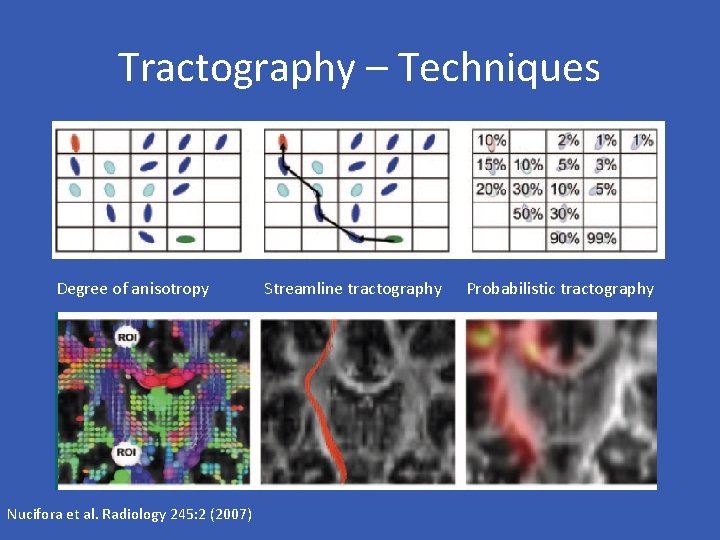 Tractography – Techniques Degree of anisotropy Nucifora et al. Radiology 245: 2 (2007) Streamline