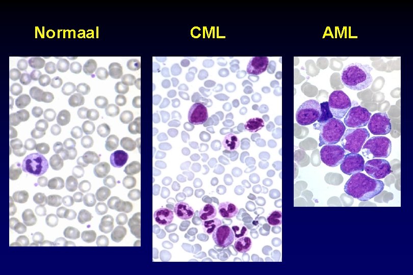 Topics in Hematology Benign hematology HematoOncology Study of