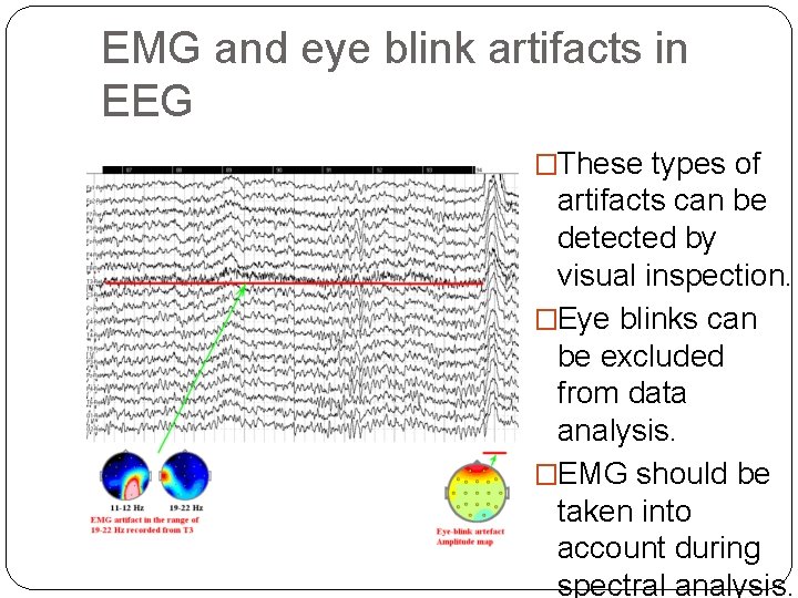 EMG and eye blink artifacts in EEG �These types of artifacts can be detected
