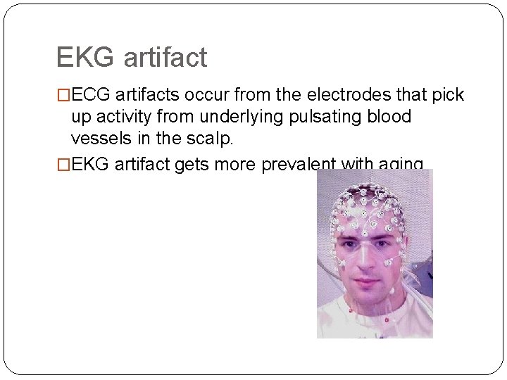 EKG artifact �ECG artifacts occur from the electrodes that pick up activity from underlying