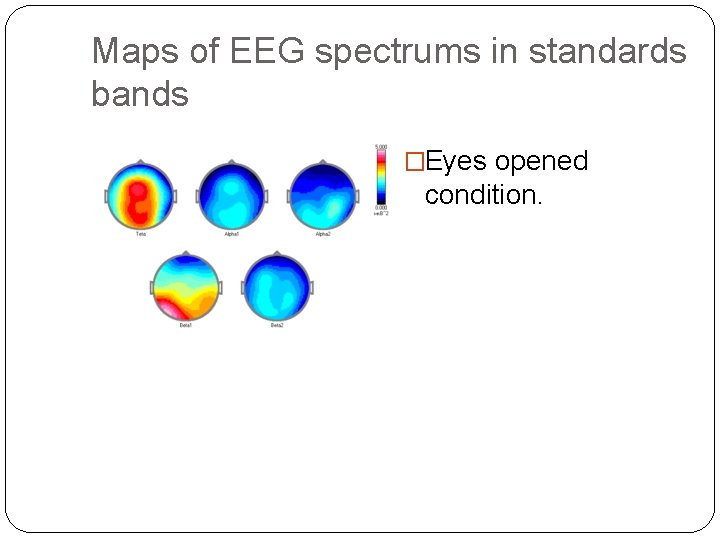 Maps of EEG spectrums in standards bands �Eyes opened condition. 