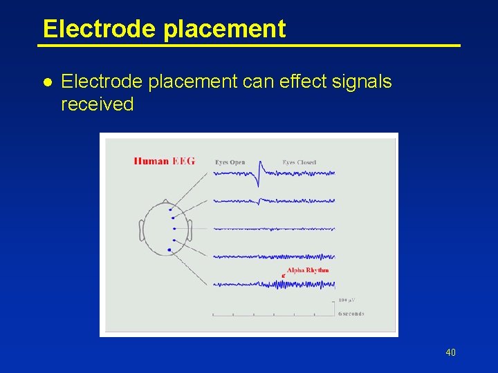 Electrode placement l Electrode placement can effect signals received 40 
