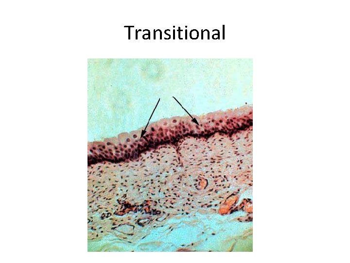 Transitional Shape Types of Epithelium Classification of Epithelia All epithelial