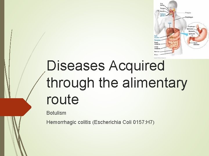 Diseases Acquired through the alimentary route Botulism Hemorrhagic colitis (Escherichia Coli 0157: H 7)