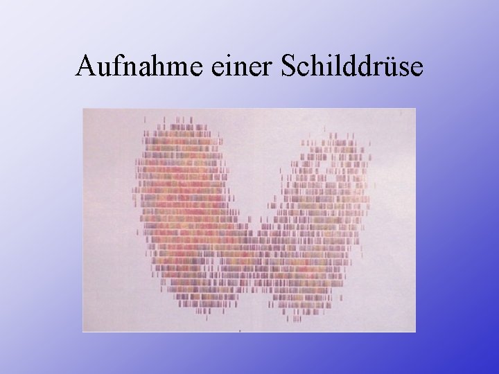 Aufnahme einer Schilddrüse 