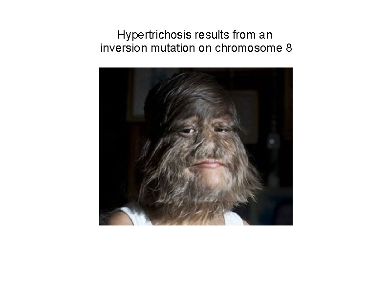 Hypertrichosis results from an inversion mutation on chromosome 8 