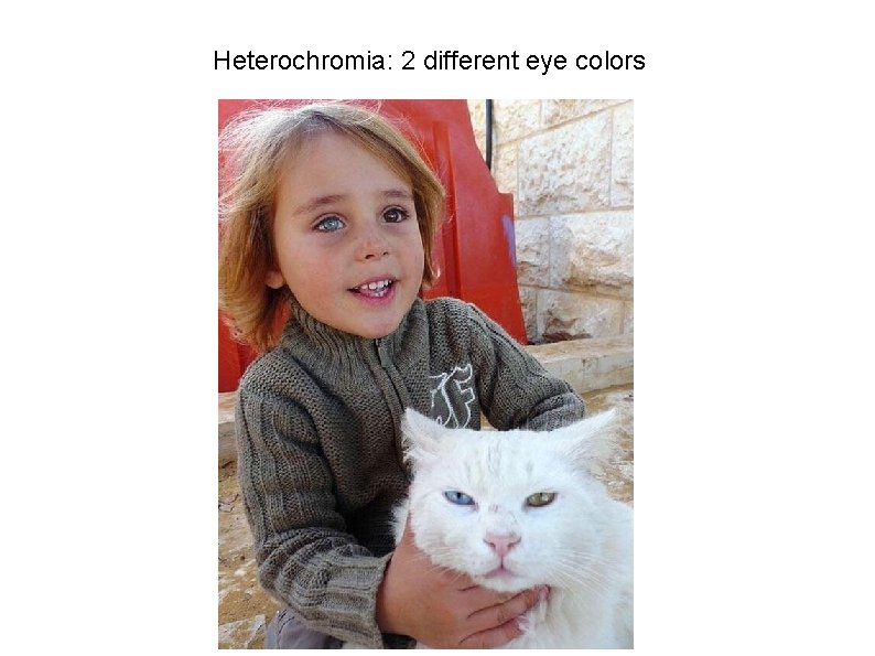 Heterochromia: 2 different eye colors 