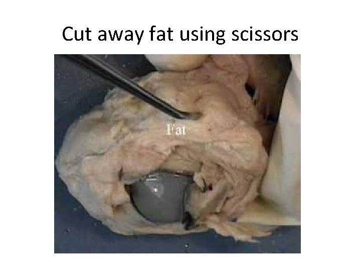Cut away fat using scissors 