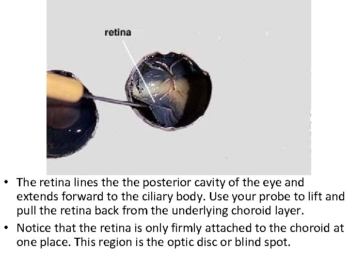  • The retina lines the posterior cavity of the eye and extends forward