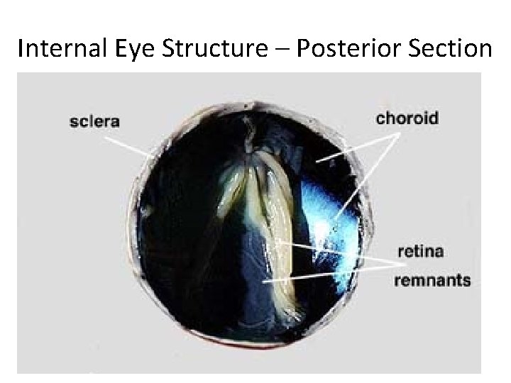 Internal Eye Structure – Posterior Section 