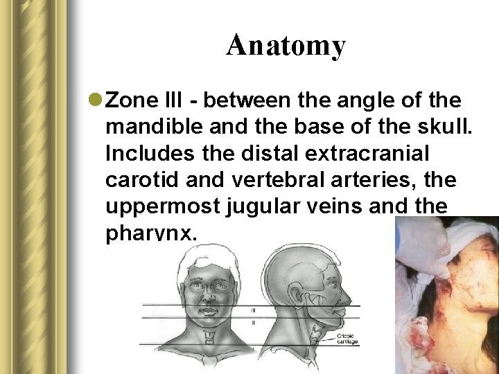 Anatomy l Zone III - between the angle of the mandible and the base