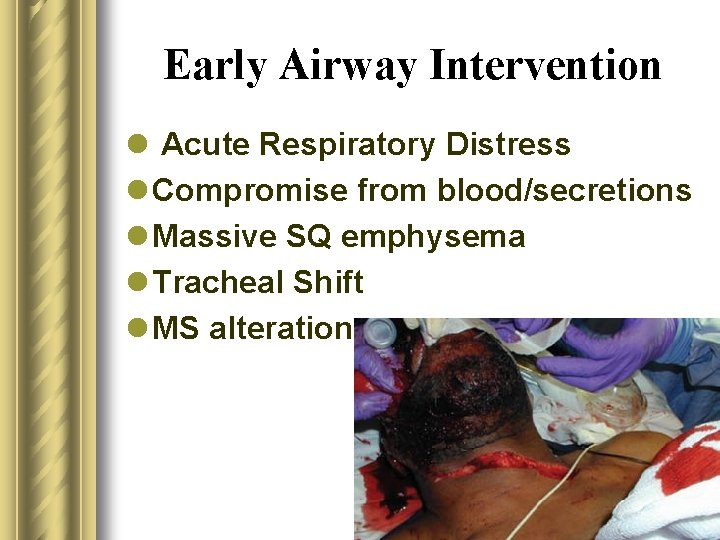 Early Airway Intervention l Acute Respiratory Distress l Compromise from blood/secretions l Massive SQ