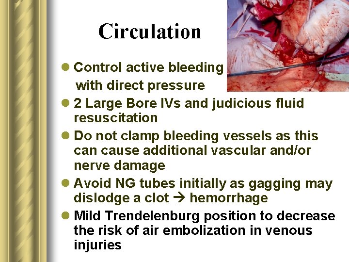 Circulation l Control active bleeding with direct pressure l 2 Large Bore IVs and