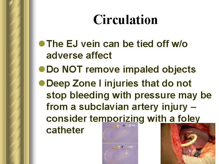 Circulation l The EJ vein can be tied off w/o adverse affect l Do