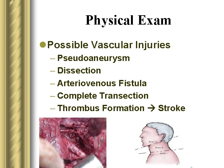 Physical Exam l Possible Vascular Injuries – Pseudoaneurysm – Dissection – Arteriovenous Fistula –