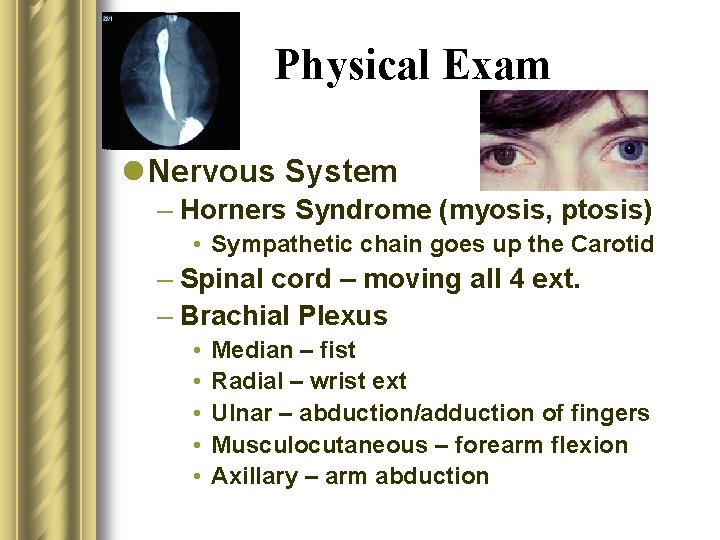 Physical Exam l Nervous System – Horners Syndrome (myosis, ptosis) • Sympathetic chain goes
