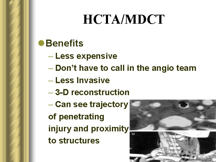 HCTA/MDCT l Benefits – Less expensive – Don’t have to call in the angio