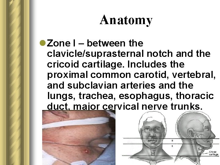 Anatomy l Zone I – between the clavicle/suprasternal notch and the cricoid cartilage. Includes