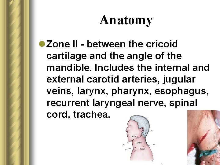 Anatomy l Zone II - between the cricoid cartilage and the angle of the
