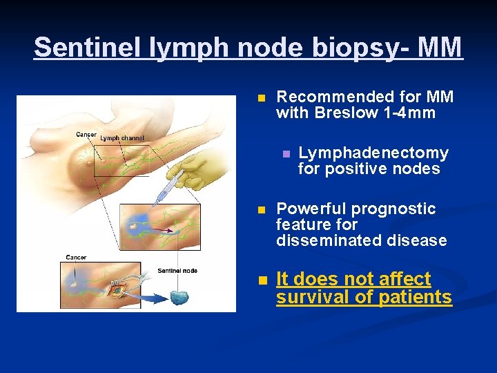 Sentinel lymph node biopsy- MM n Recommended for MM with Breslow 1 -4 mm