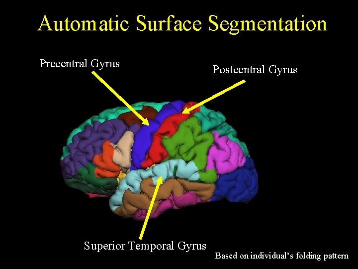 Automatic Surface Segmentation Precentral Gyrus Superior Temporal Gyrus Postcentral Gyrus Based on individual’s folding