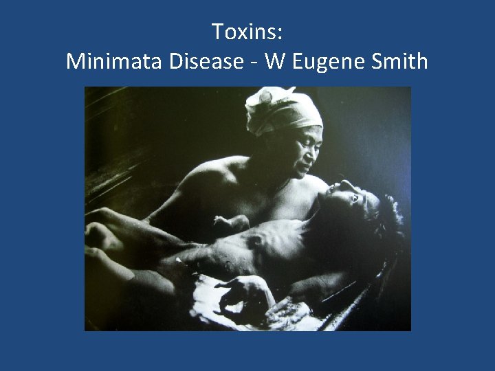 Toxins: Minimata Disease - W Eugene Smith 