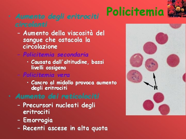  • Aumento degli eritrociti circolanti Policitemia – Aumento della viscosità del sangue che