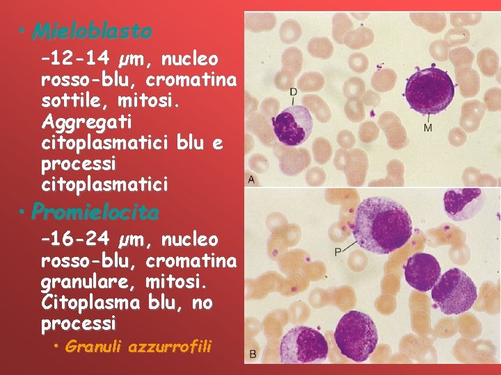  • Mieloblasto – 12 -14 µm, nucleo rosso-blu, cromatina sottile, mitosi. Aggregati citoplasmatici