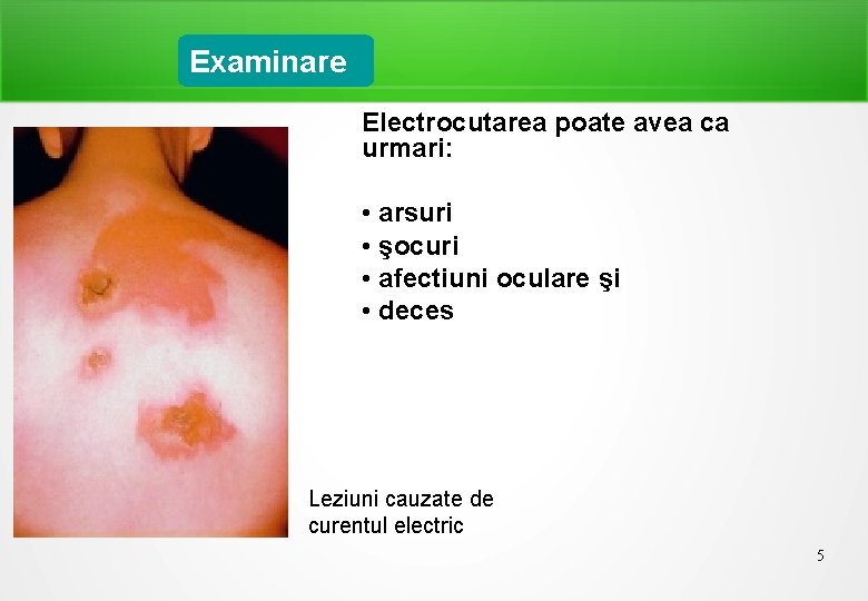 Examinare Electrocutarea poate avea ca urmari: • arsuri • şocuri • afectiuni oculare şi