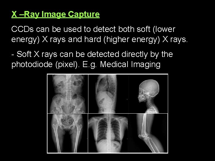 X –Ray Image Capture CCDs can be used to detect both soft (lower energy)