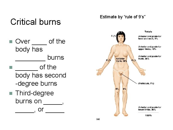 Critical burns n n n Over ____ of the body has ____ burns ______