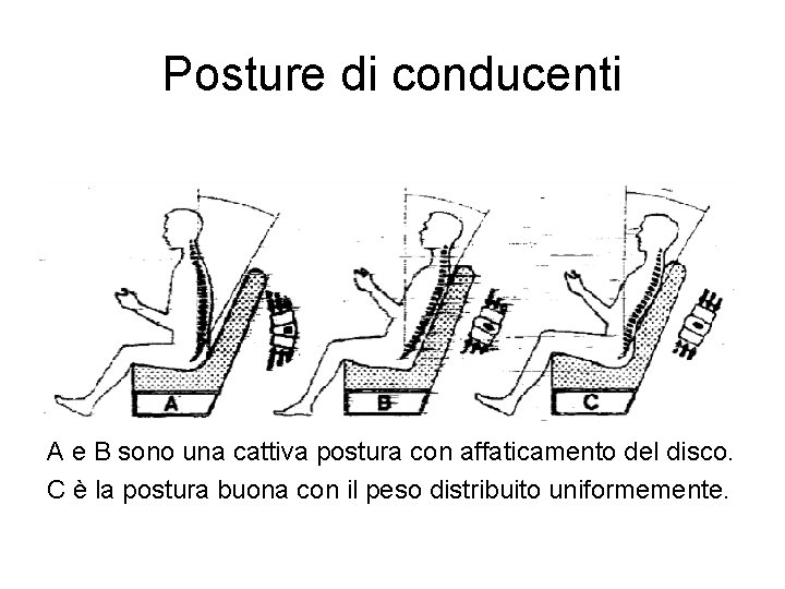 Posture di conducenti A e B sono una cattiva postura con affaticamento del disco.